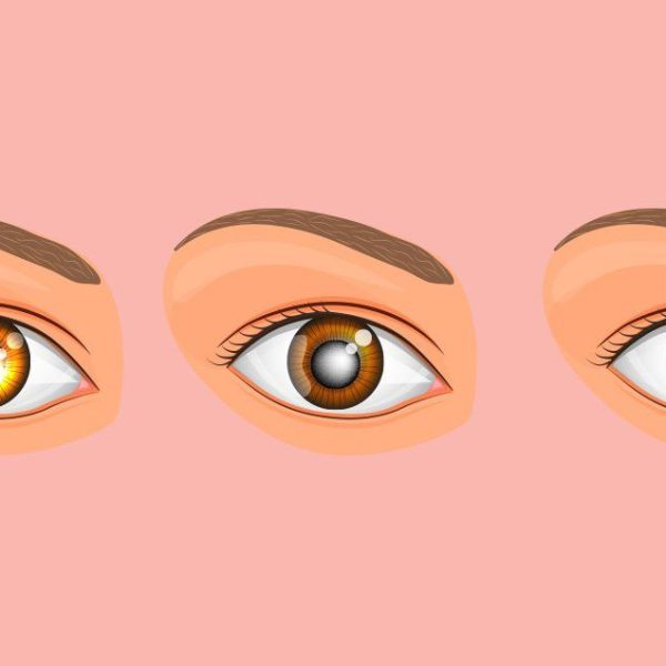 Understanding and Preventing Common Eye Diseases: Glaucoma and Diabetic Retinopathy