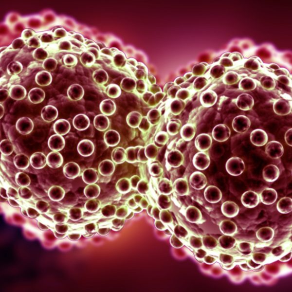 Understanding Different Types of Cancer and Breast Cancer: Symptoms, Diagnosis, and Treatment Options