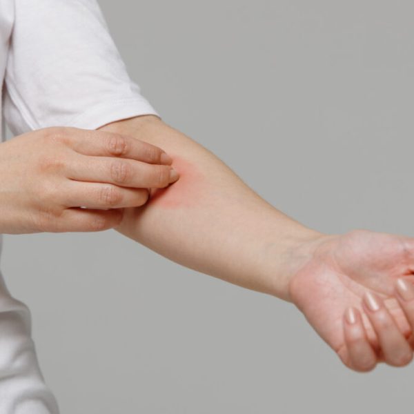Understanding Syphilis: Symptoms, Transmission, and Treatment